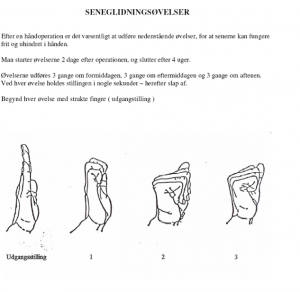 seneglidningsøvelser seneglidning karpaltunnelsyndrom karpaltunnel